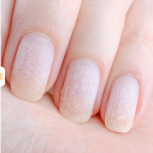 Ôdass Paris Miracle soin ongles fragiles 10 ml