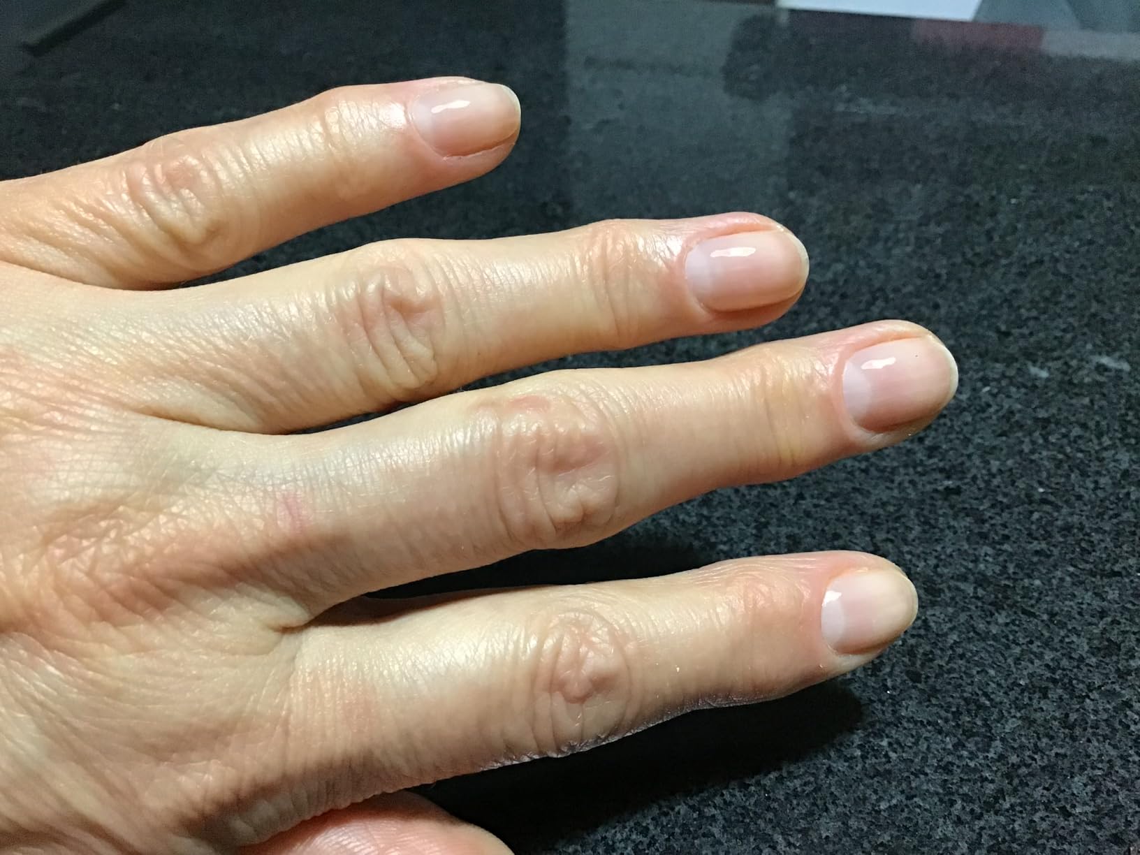 Manucurist Base S.O.S. soin fortifiant ongles très abîmés
